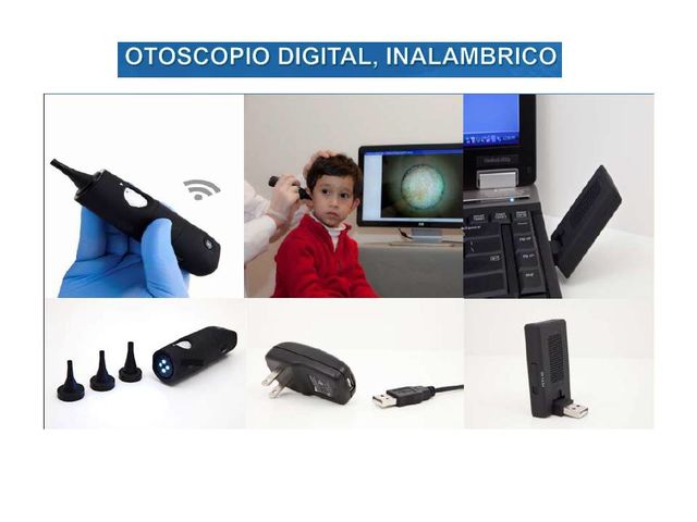 Otoscopio Digital